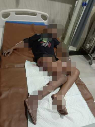 Tiga Anak di Cilacap Luka Akibat Ledakan Mercon, Polisi Imbau Warga Waspada