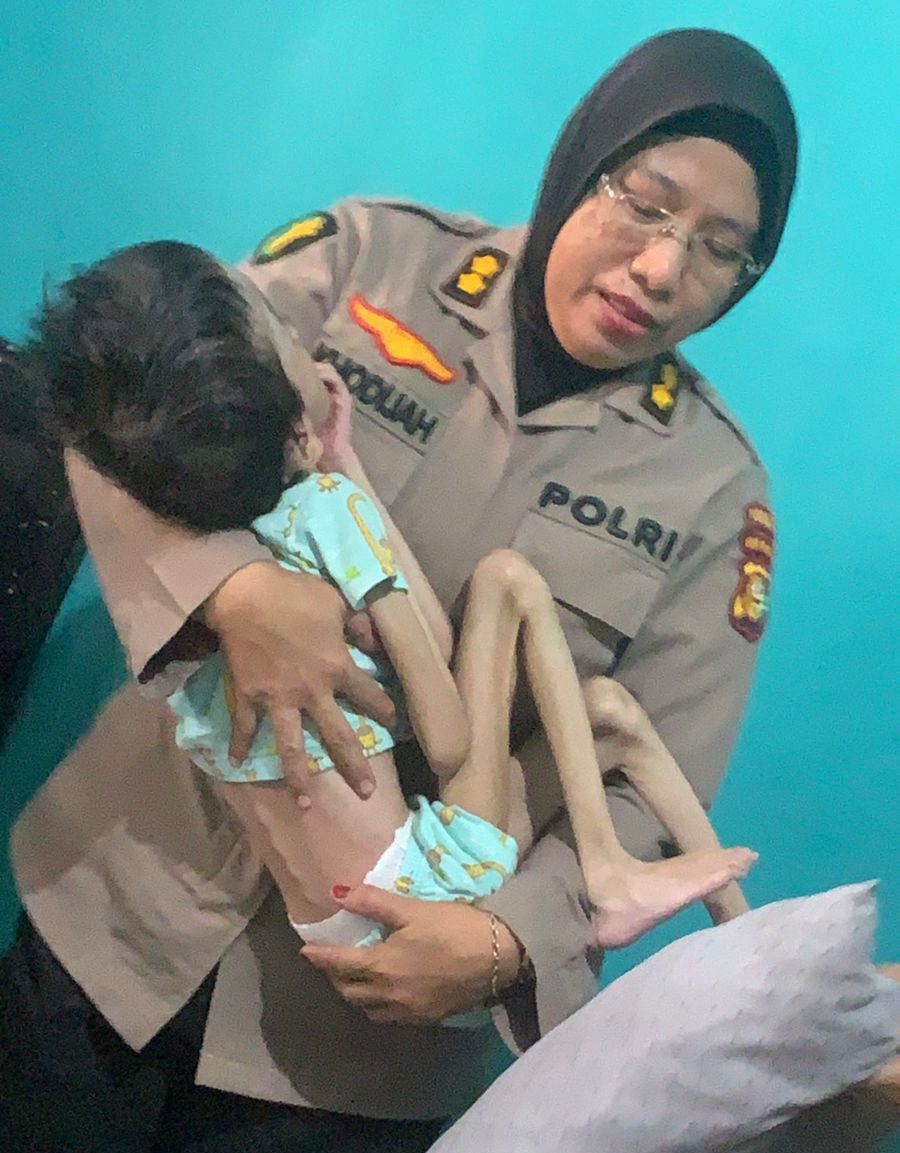 Kisah Pilu Siti Fadilla, Anak Penderita Hidrosefalus Dibuang Orang Tuanya Ini Tampak Ceria Digendong Polwan