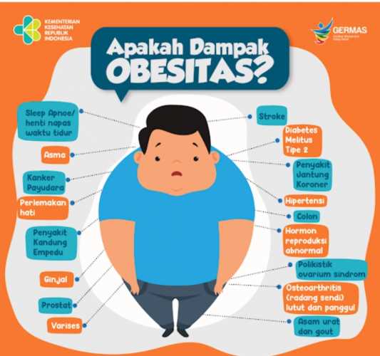 Kadinkes Inhil Sebut Penyebab Utama Obesitas Pada Anak