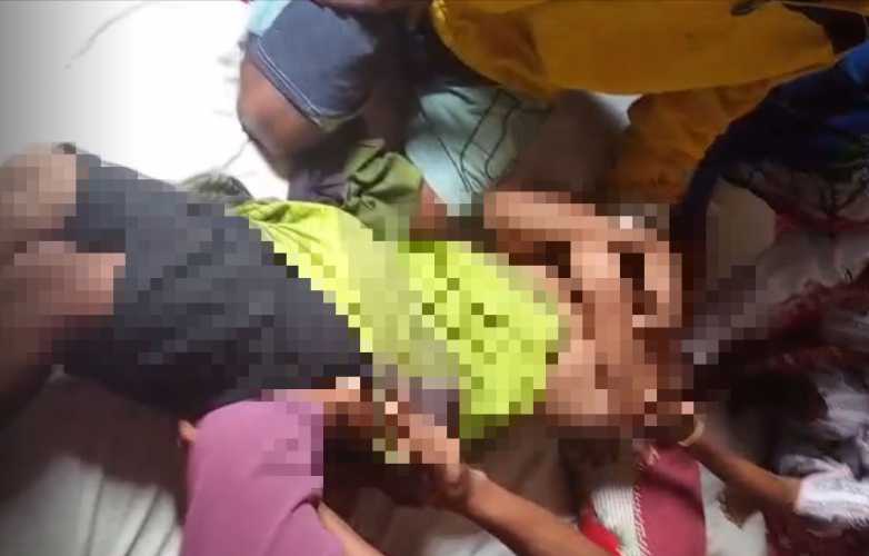 Remaja 13 Tahun Tersambar Petir Saat Cari Kerang, Sempat Tak Sadarkan Diri dan Alami Trauma