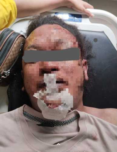 Jurnalis Medan Tewas Misterius di Kos Jalan PWS, Polisi Diminta Usut Tuntas Dugaan Pembunuhan